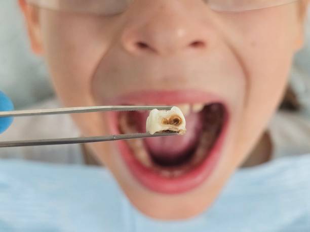 Best Weekend Emergency Dental Services in Garrison, MD